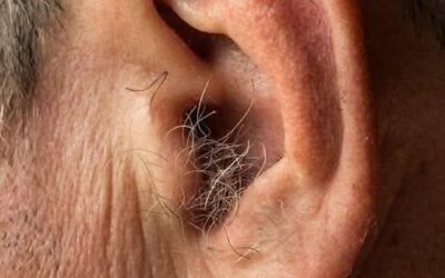 Cuando el cuerpo habla: lo que el vello en tus orejas revela