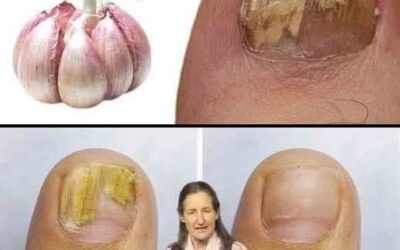 El ajo: un remedio natural y efectivo contra los hongos en los pies