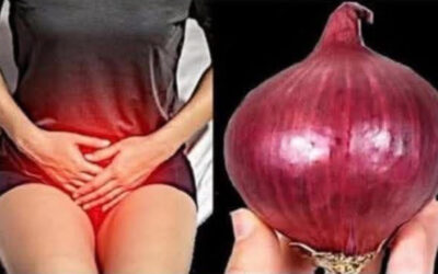 La cebolla