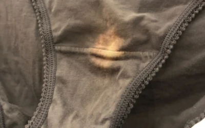 Manchas en la Ropa