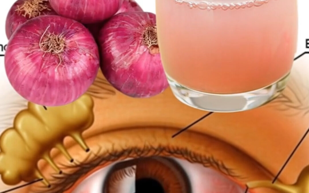 LA CEBOLLA Y LA VISIÓN: