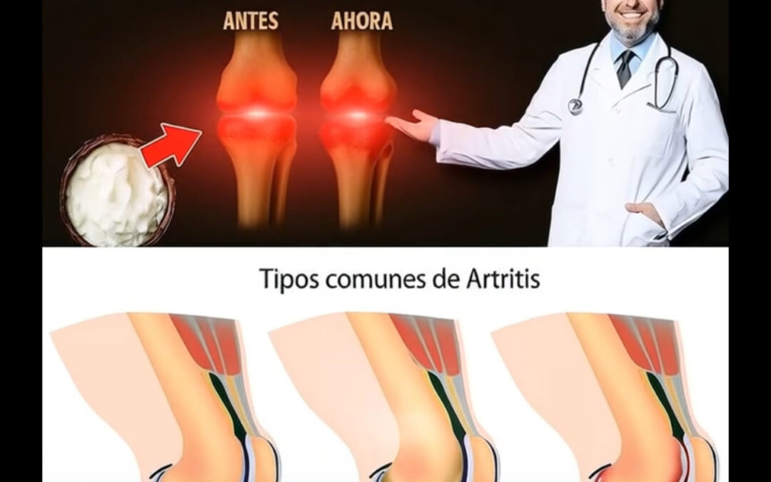 LA VERDAD SOBRE LA ALIMENTACIÓN Y LA SALUD DE TUS ARTICULACIONES