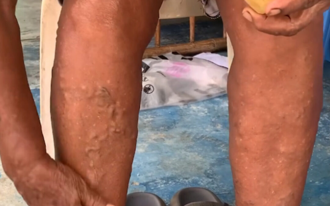 El Cura Pie: El Remedio Natural que Combate la Artritis y Mejora tu Salud