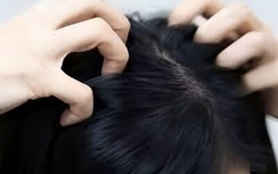 Te pica la cabeza? Estas son las principales causas