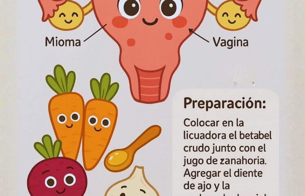 Los miomas uterinos