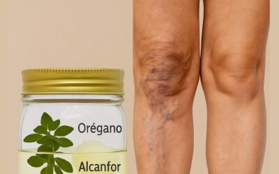 🌿 Remedio natural tradicional para el alivio de las varices