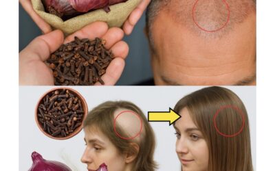 Crece Tu Cabello Con Cáscaras De Cebolla Y Clavos De Olor
