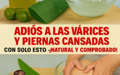 várices… con solo 3 ingredientes de cocina