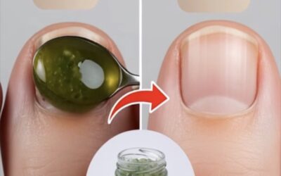 Adiós a los Hongos: