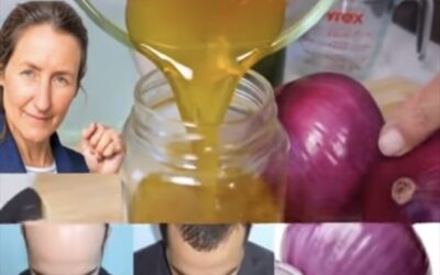 El Aceite de Cebolla: