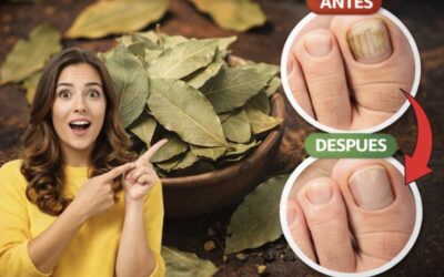 Laurel para hongos en las uñas
