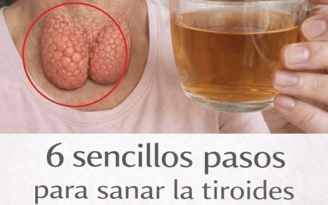Remedios para curar las glándulas tiroides