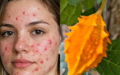 El melón amargo paras los granos y acné en la cara